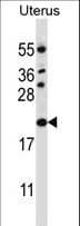 Polyclonal Rabbit anti-Human CDKN1B / p27 Kip1 Antibody (aa147-176, IHC, WB)