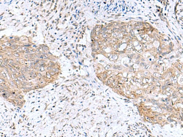 PAM16 Antibody