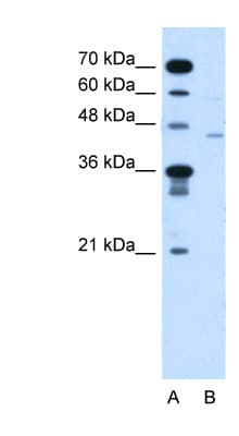 FKTN / Fukutin Antibody (aa111-160, HRP)