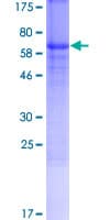 Human ZP3 Protein (Recombinant GST)