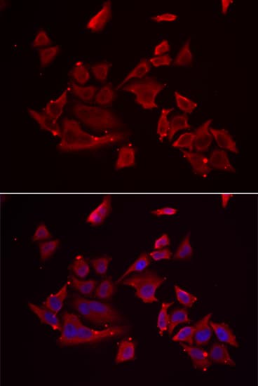 RARRES2 / Chemerin Antibody