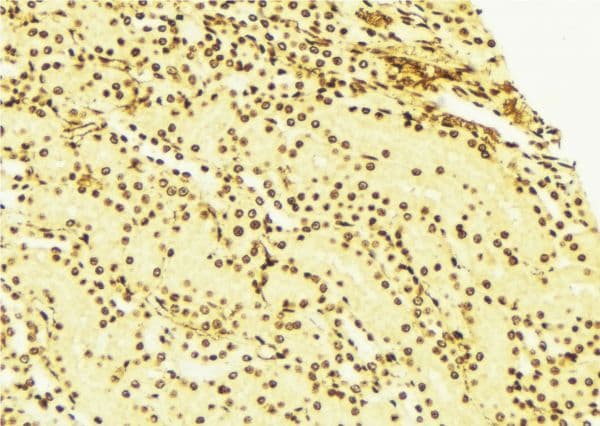 SPHK / SPHK1 Antibody
