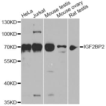Polyclonal Rabbit anti-Human IGF2BP2 Antibody (IF, WB)