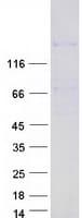 Human HMGXB3 / SMF Protein (Recombinant Myc-DDK (Flag))
