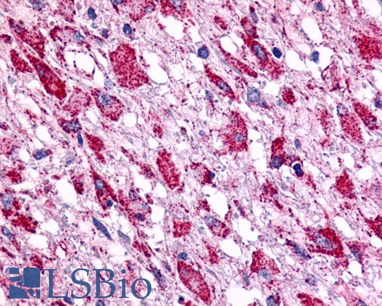 PathPlus™ BOB / GPR15 Antibody (Cytoplasmic Domain)