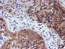 TIP48 / RUVBL2 Antibody (clone OTI1D9)
