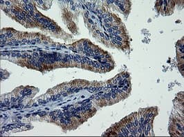 MAPK9 / JNK2 Antibody (clone OTI2H3)