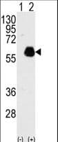 PXN / Paxillin Antibody (Tyr118)