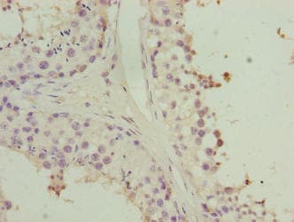 HORMAD2 Antibody