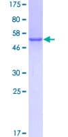Human ARHGDIB / D4 GDI Protein (Recombinant GST)