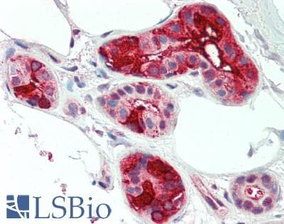 IHC-plus™ Polyclonal Rabbit anti-Human PIP / GCDFP-15 Antibody (IHC, IF)