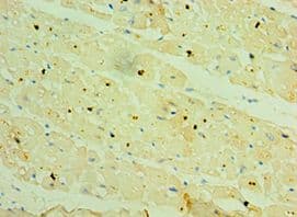 Polyclonal Rabbit anti-Human HSPB2 / HSP27 Antibody (aa1-182, IHC)