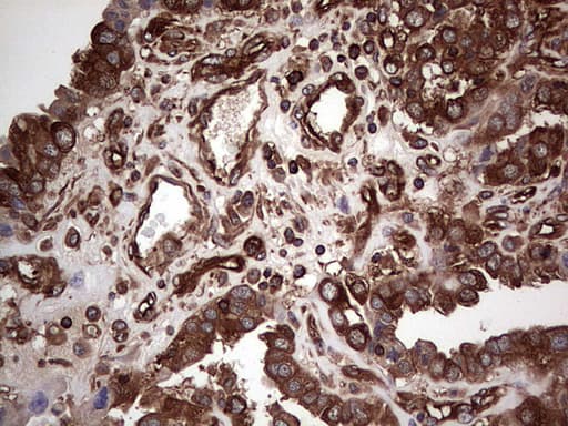 LRRTM1 Antibody (aa182-422, clone OTI5H9)
