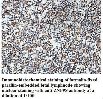 ZNF98 Antibody (aa57-314)