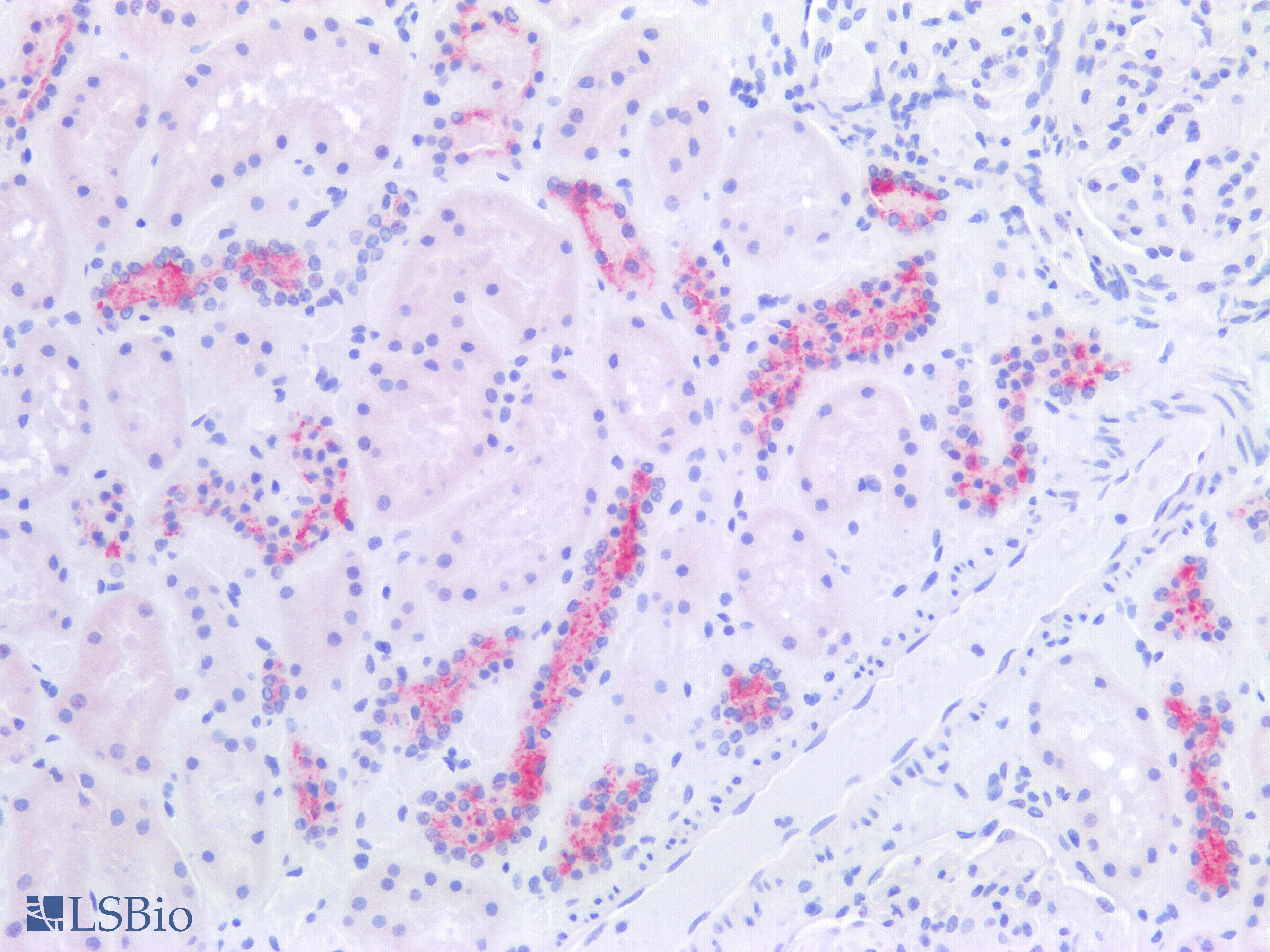 PathPlus™ EMA / MUC1 Antibody (Internal)