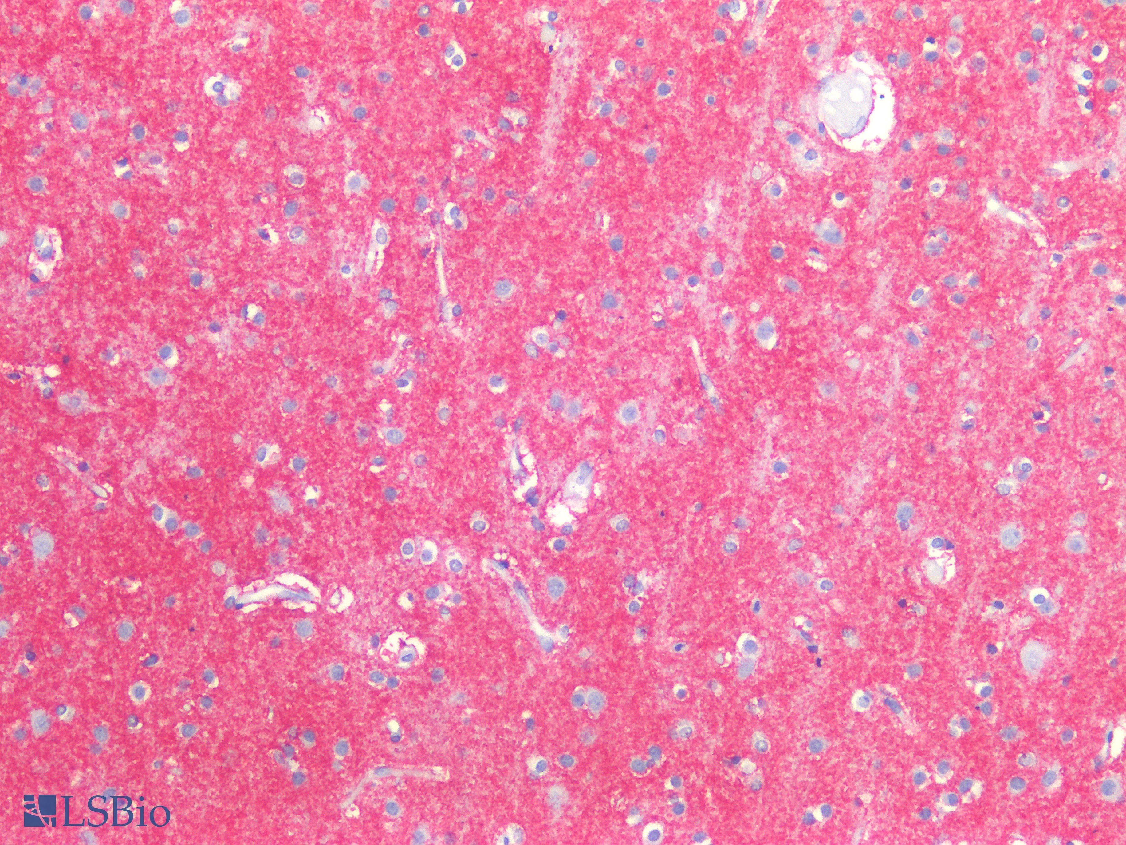 PathPlus™ Polyclonal Rabbit anti-Human SLC1A2 / EAAT2 / GLT-1 Antibody (Cytoplasmic Domain, IHC, WB)