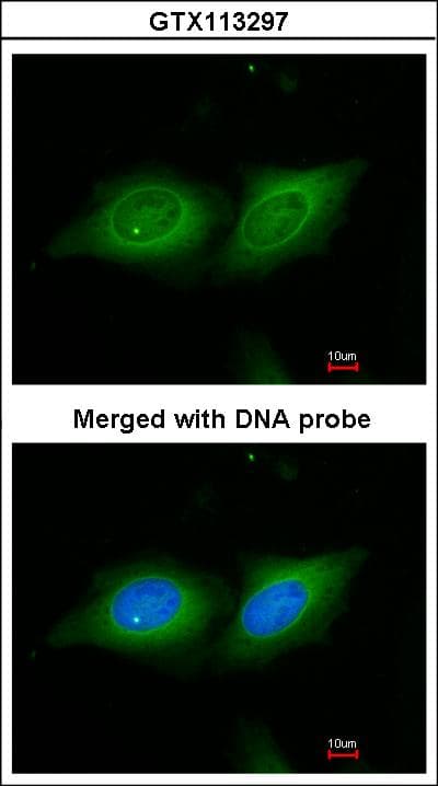 IHC-plus™ YWHAB / 14-3-3 Beta Antibody