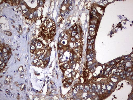 Monoclonal Mouse anti-Human KRT7 / CK7 / Cytokeratin 7 Antibody (clone OTI3B7, IHC, WB)