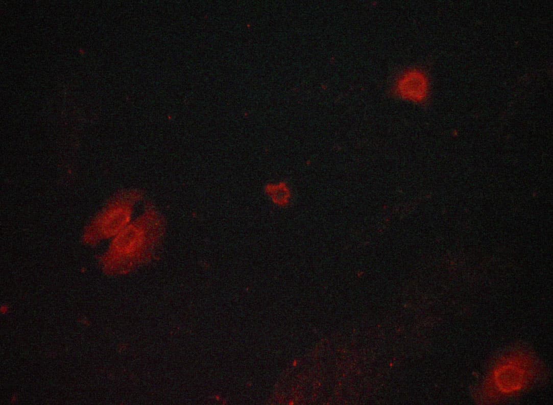 GSK3B / GSK3 Beta Antibody (phospho-Ser9)