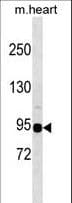 Polyclonal Rabbit anti-Mouse SNRK Antibody (aa683-710, WB)