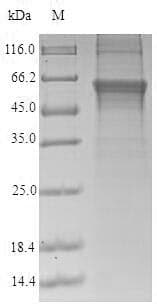 Human CRBN / Cereblon Protein (Recombinant 6His, N-terminus)