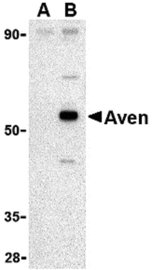 IHC-plus™ AVEN / PDCD12 Antibody
