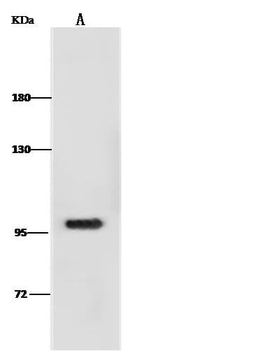 ANO1 / DOG1 / TMEM16A Antibody (clone 006, Preservative Free)