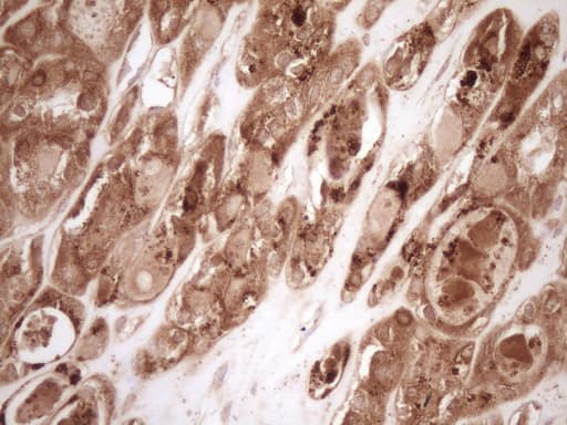 BCL2 / Bcl-2 Antibody (clone OTI9D3)
