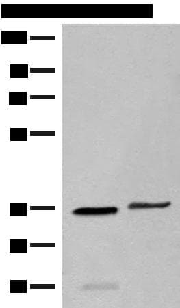 Polyclonal Rabbit anti-Human GAL4 / Galectin 4 Antibody (IHC, WB)