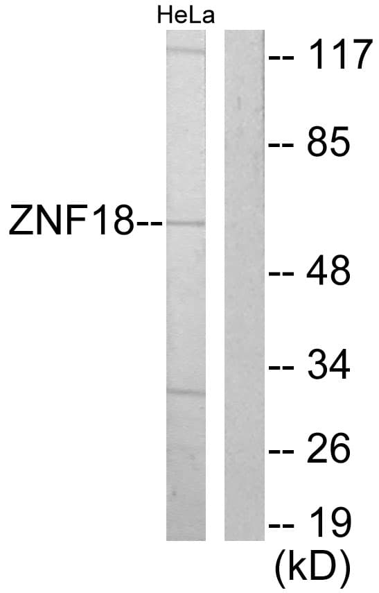 ZNF18 Antibody (aa261-310)