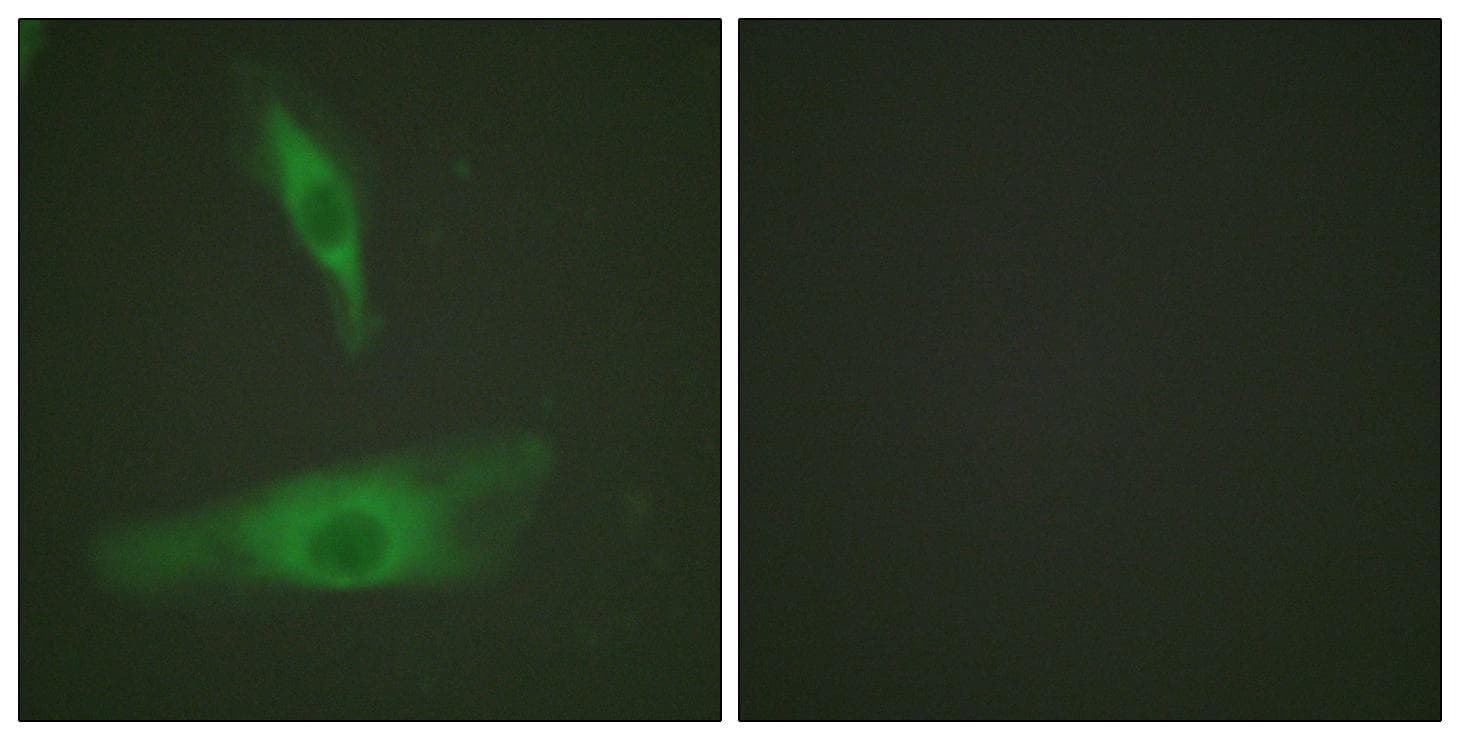 ADD1 / Adducin Alpha Antibody (p726)