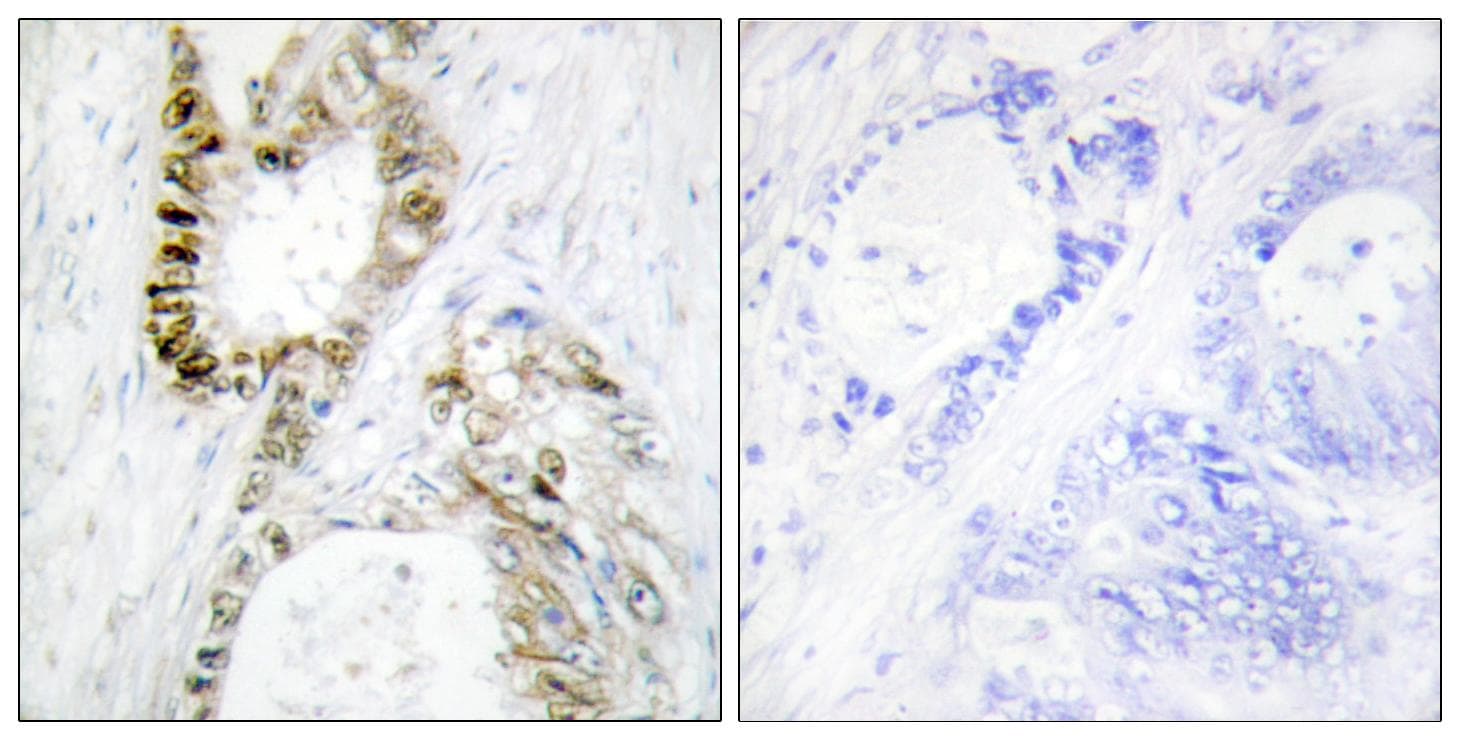 Polyclonal Rabbit anti-Human FANCA Antibody (IHC)
