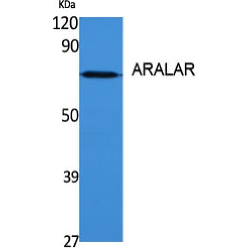 Polyclonal Rabbit anti-Human SLC25A12 / ARALAR Antibody (360-440 aa, Internal, IHC, WB)