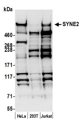 Polyclonal Rabbit anti-Human SYNE2 / Nesprin-2 Antibody (aa4200-4250, WB)