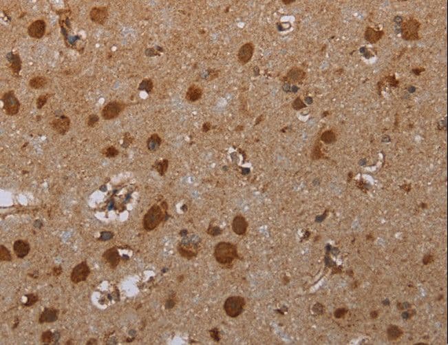 ATP2A1 / SERCA1 Antibody