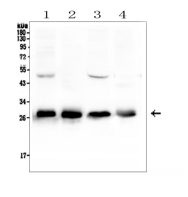 IHC-plus™ CALB1 / Calbindin Antibody