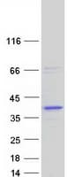Human RDH13 Protein (Recombinant Myc-DDK (Flag))