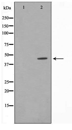 IHC-plus™ Polyclonal Rabbit anti-Human CDK15 / ALS2CR7 Antibody (IHC, WB)