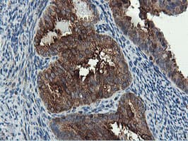 PFKP Antibody (clone OTI1A11)