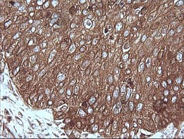 MAP2K1 / MKK1 / MEK1 Antibody (clone OTI2B2, Carrier-free)