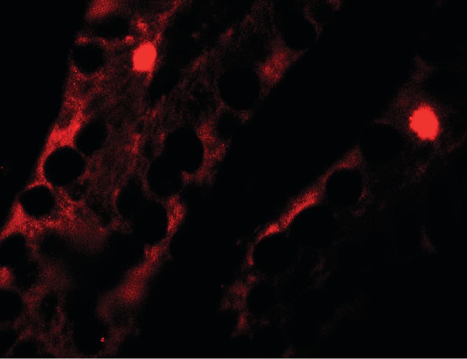 MTERF4 / MTERFD2 Antibody