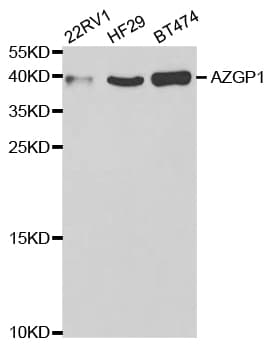 Polyclonal Rabbit anti-Human AZGP1 / ZAG Antibody (IHC, IF, WB)