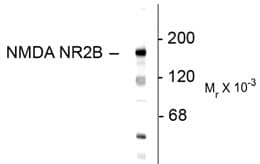 GRIN2B / NMDAR2B / NR2B Antibody (N-Terminus)