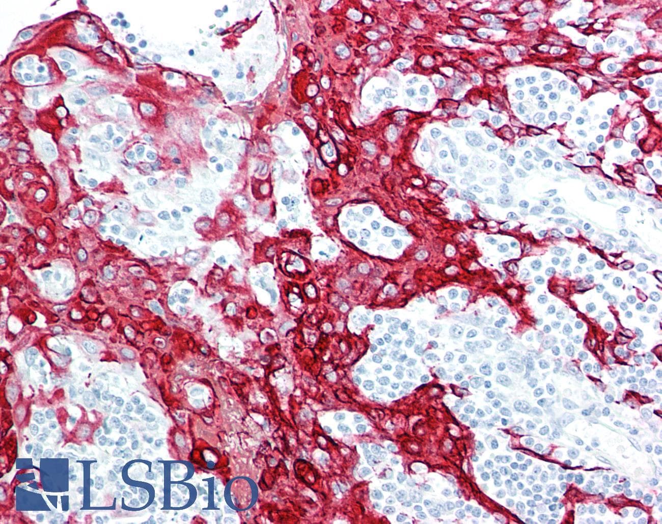PathPlus™ KRT13 / CK13 / Cytokeratin 13 Antibody