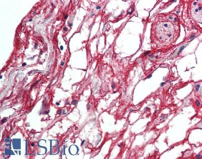 IHC-plus™ MFAP5 / MAGP2 Antibody (aa22-173)