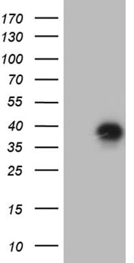 CD79B / CD79 Beta Antibody (clone OTI3E3, Carrier-free)