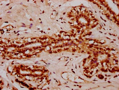 HIST1H2AI Antibody
