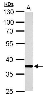 IHC-plus™ AKR1B10 Antibody (aa1-316)