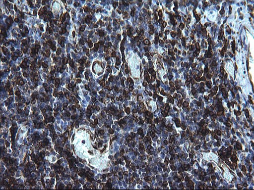 CD74 / CLIP Antibody (clone OTI1G10, Carrier-free)