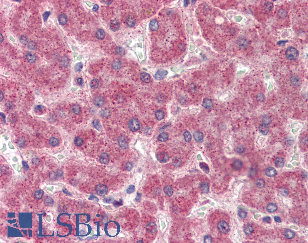 IHC-plus™ F2 / Prothrombin / Thrombin Antibody (aa396-445)